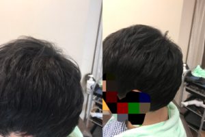 パーマの代わりに増毛でボリュームアップ 大阪エクステ増毛 ヘアーズ男爵